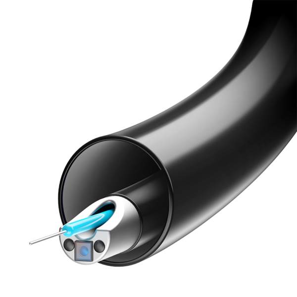 Innovex Single-Use 7.5 Fr Flexible Ureteroscope - Image 5