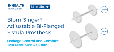 BLOM-SINGER® ADJUSTABLE BI-FLANGED FISTULA PROSTHESIS