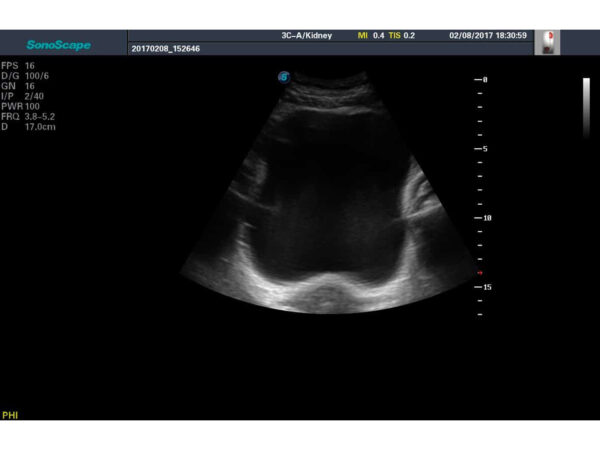 S8 EXP Portable Ultrasound System - Image 4