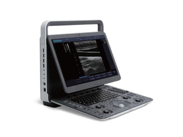 E1 Portable B/W Ultrasound