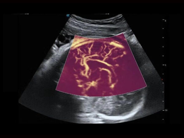 P60 EXP Colour Doppler System - Image 7