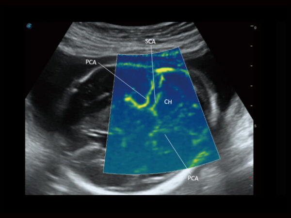 P60 EXP Colour Doppler System - Image 4