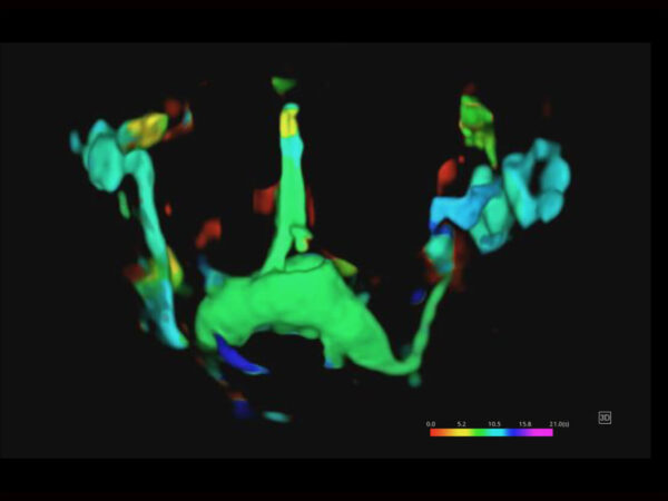 P60 EXP Colour Doppler System - Image 6