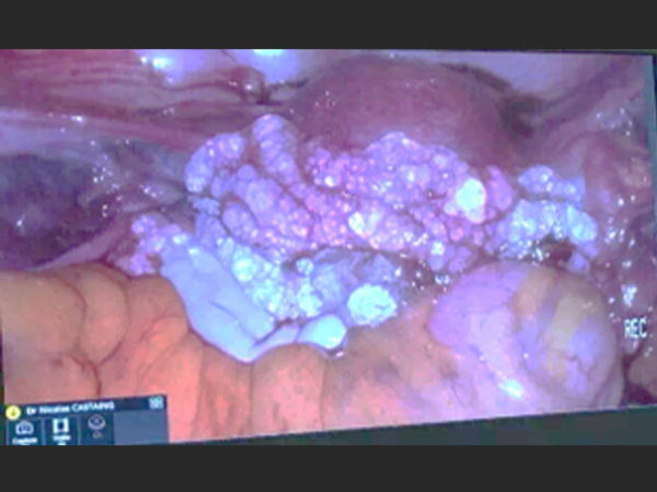 HyaRegen® Gel - Image 4