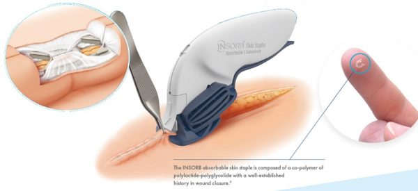 INSORB Absorbable Skin Stapler