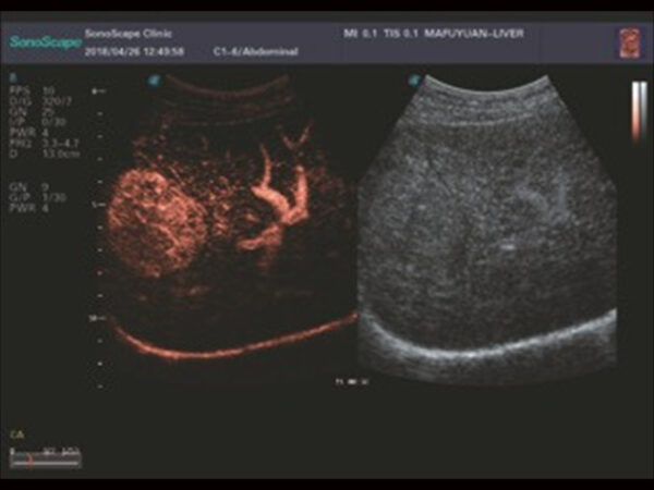 P25 Elite Premium Colour Doppler System - Image 4