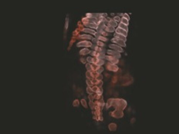 P25 Elite Premium Colour Doppler System - Image 5