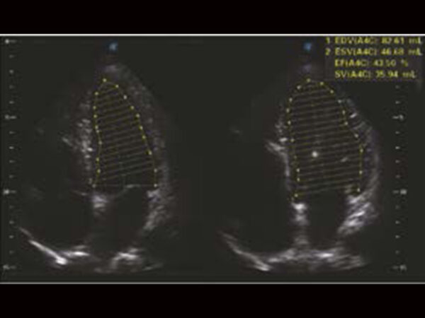P25 Elite Premium Colour Doppler System - Image 6