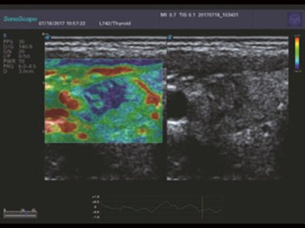 P25 Elite Premium Colour Doppler System - Image 7
