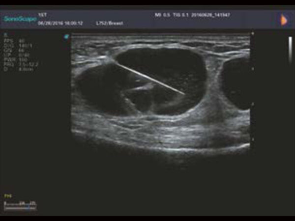 P25 Elite Premium Colour Doppler System - Image 8