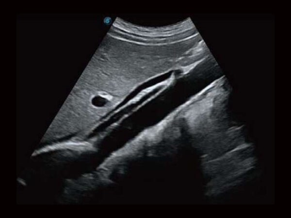 P50EXP Premium Colour Doppler System - Image 3