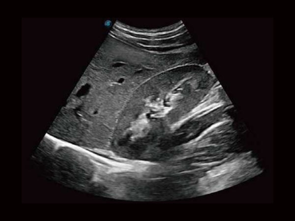 P50EXP Premium Colour Doppler System - Image 4