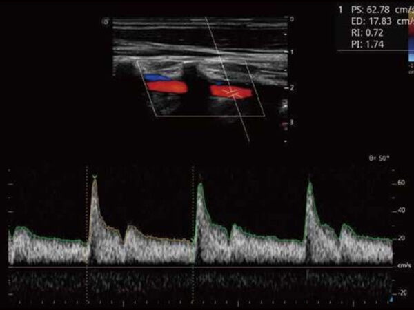P50EXP Premium Colour Doppler System - Image 5