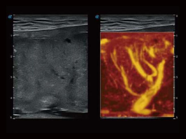 P50EXP Premium Colour Doppler System - Image 6