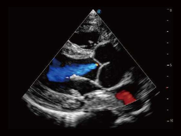 P50EXP Premium Colour Doppler System - Image 8