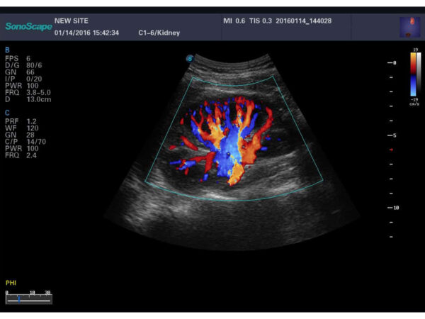 S8 EXP Portable Ultrasound System - Image 5