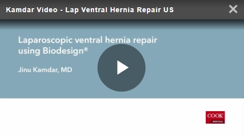 Laparoscopic Ventral Hernia Repair Using Biodesign