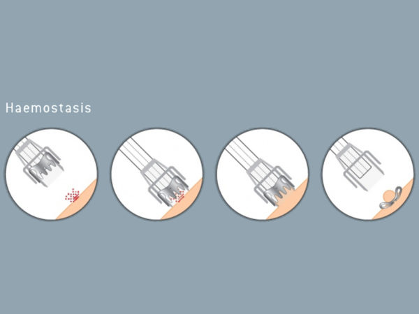 Ovesco OTSC Haemostasis