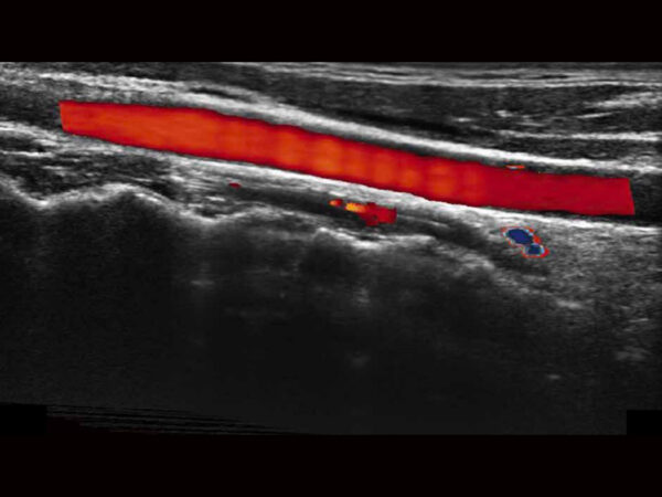 P11 Elite Premium Colour Doppler System - Image 5