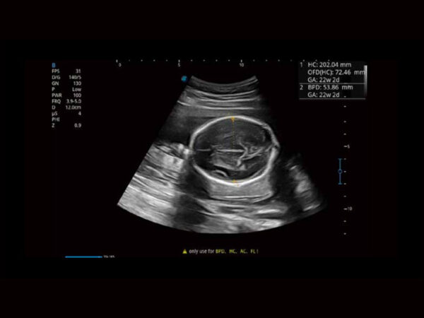 P11 Elite Premium Colour Doppler System - Image 6