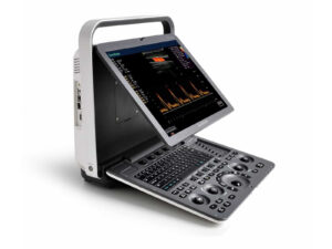 S8 EXP Portable Ultrasound System
