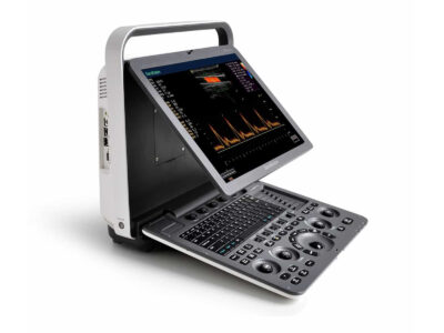 S8 EXP Portable Ultrasound System