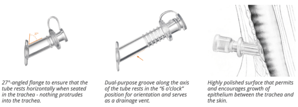 MONTGOMERY® LONG-TERM CANNULA - Image 2