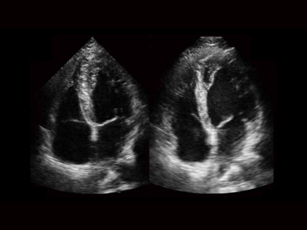 P11 Elite Premium Colour Doppler System - Image 8
