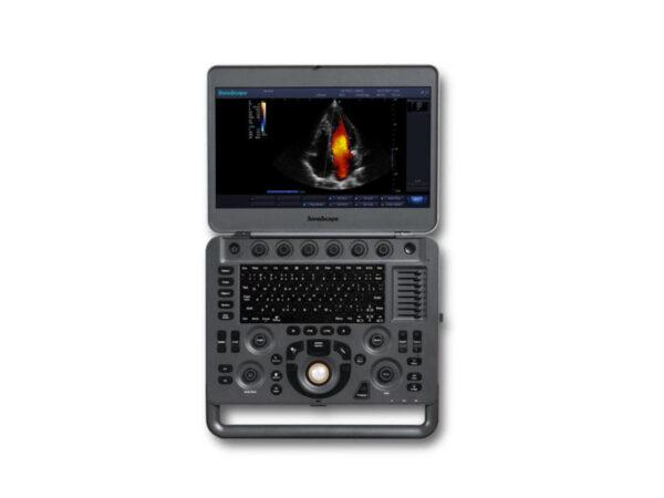 X3 Portable Colour Doppler Ultrasound - Image 2