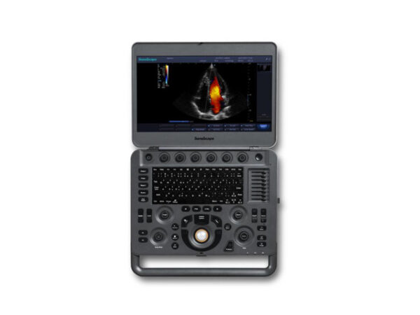 X5 Portable Colour Doppler Ultrasound - Image 2