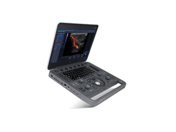 X3 Portable Colour Doppler Ultrasound - Image 3