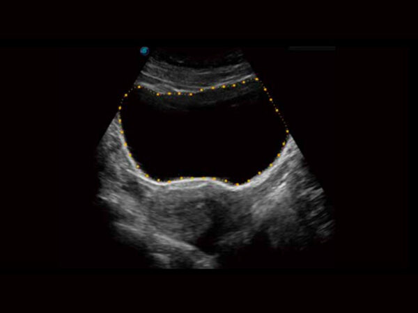 P11 Elite Premium Colour Doppler System - Image 4