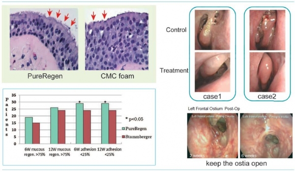 PureRegen Proven Results