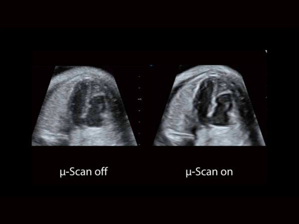 P11 Elite Premium Colour Doppler System - Image 7